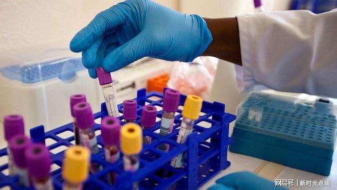 特殊干细胞移植成功，全球第5位艾滋病治愈者出现